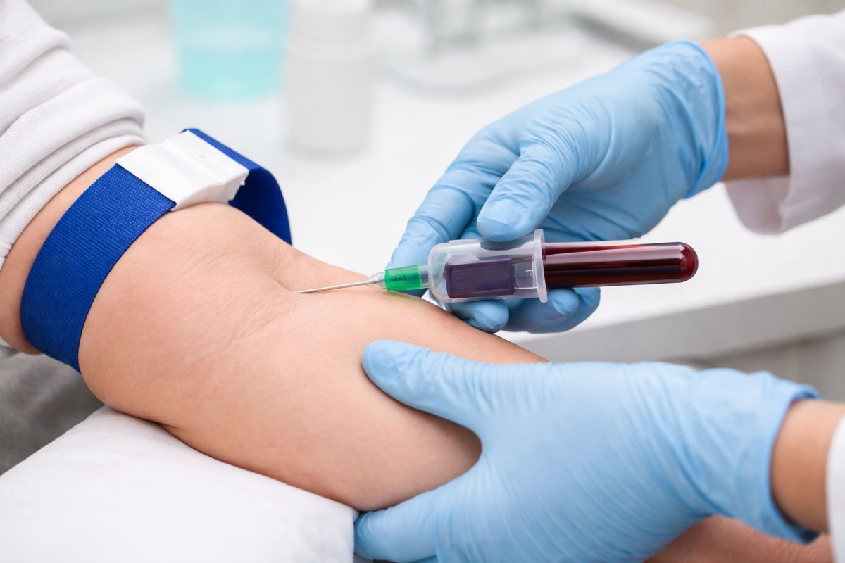 Pobieranie krwi z żyły – bliski plan procedury w gabinecie medycznym